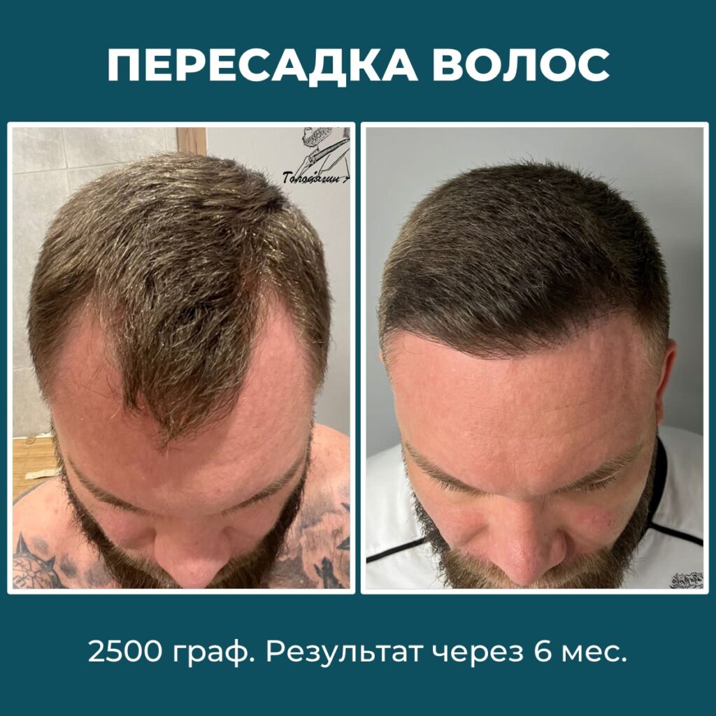 33а3а3а